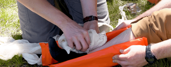 Using Cravats to pad voids during splinting